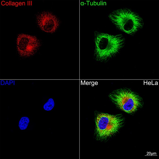 Collagen III alpha 1/COL3A1 Antibody (6Y9C6)