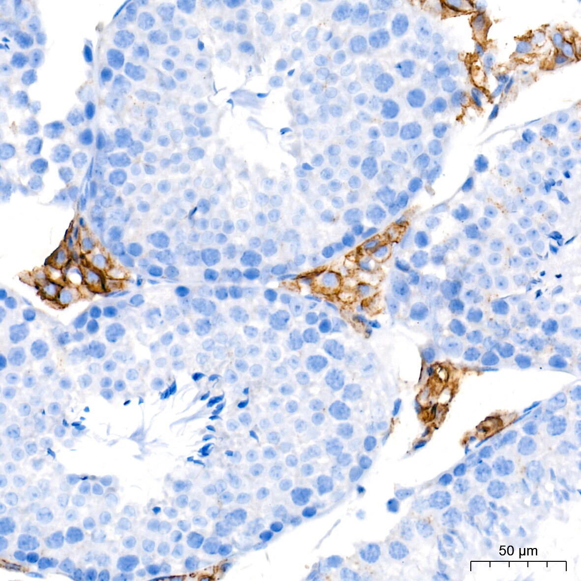 SR-BI Antibody (1C1I8)