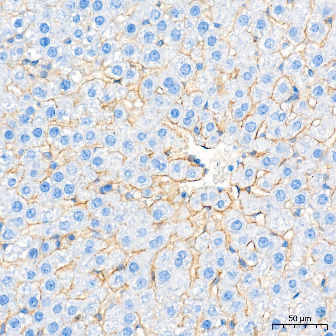 SR-BI Antibody (1C1I8)