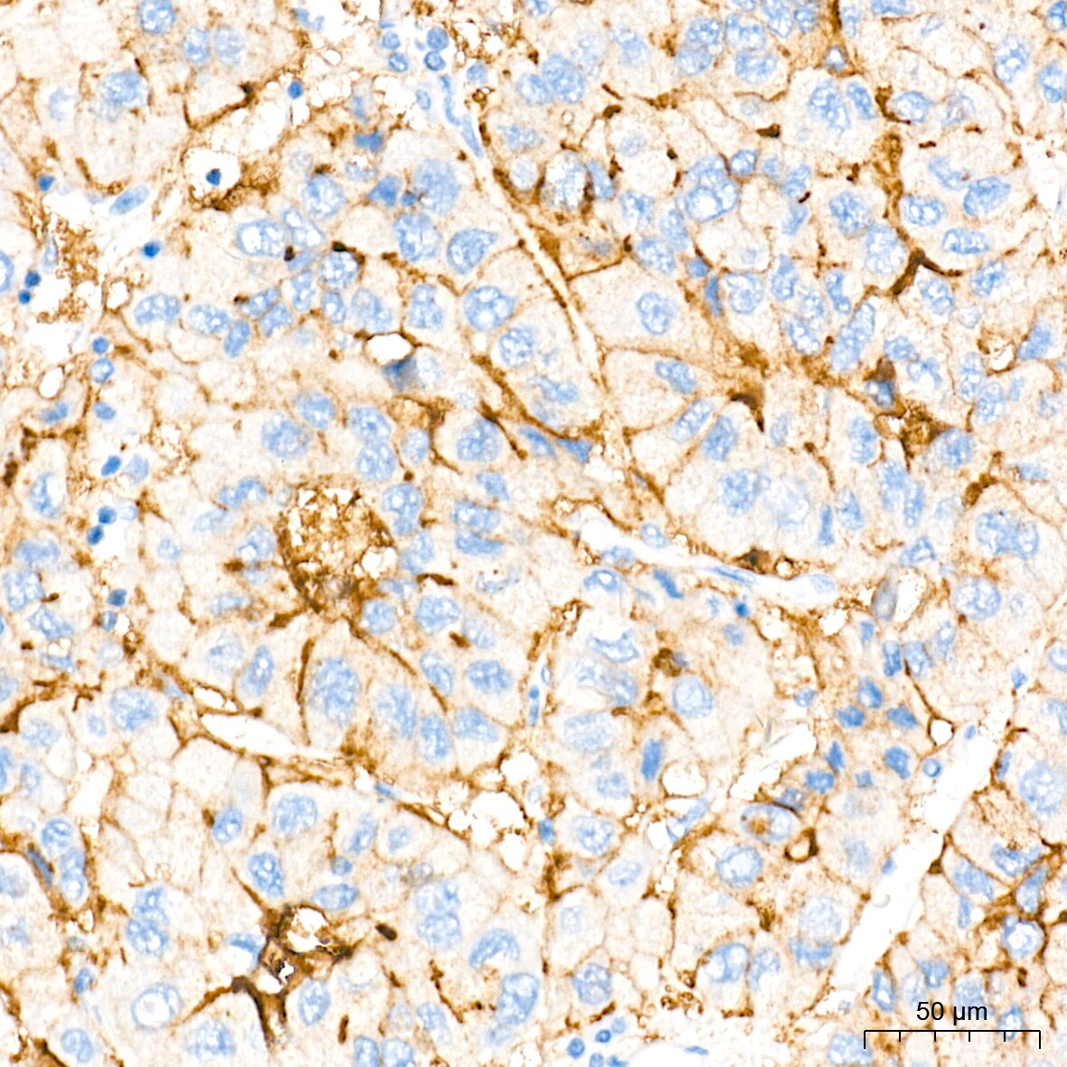 SR-BI Antibody (1C1I8)