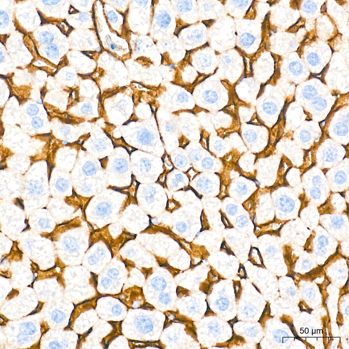SR-BI Antibody (1C1I8)