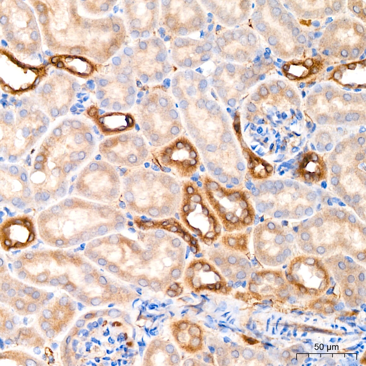 Microsomal Glutathione S-transferase 1 Antibody (6A0S5)