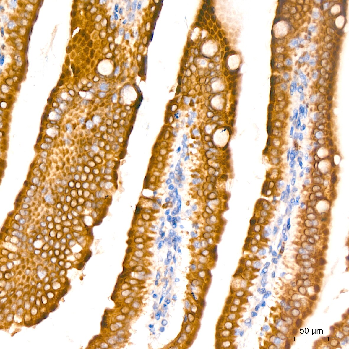 Microsomal Glutathione S-transferase 1 Antibody (6A0S5)