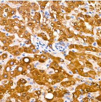 Microsomal Glutathione S-transferase 1 Antibody (6A0S5)