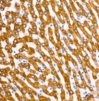 Microsomal Glutathione S-transferase 1 Antibody (6A0S5)