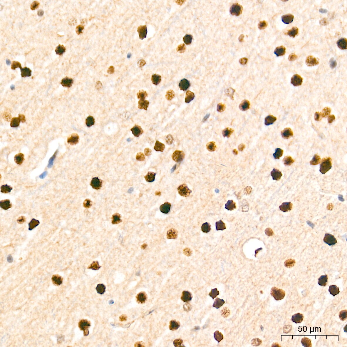 HES-1 Antibody (9I2E8)