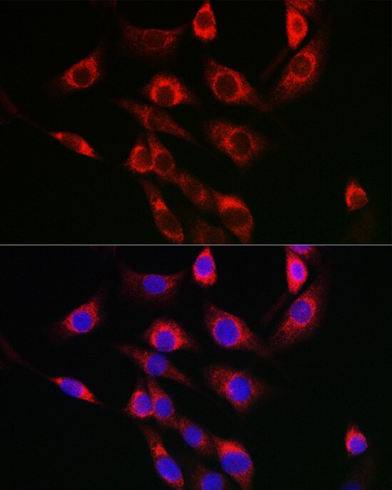 FBXO6 Antibody - BSA Free