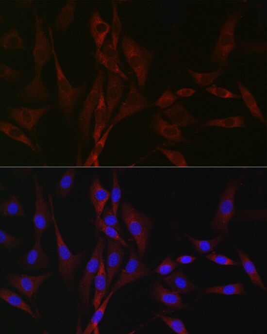 Cav3.2 Antibody - Azide and BSA Free