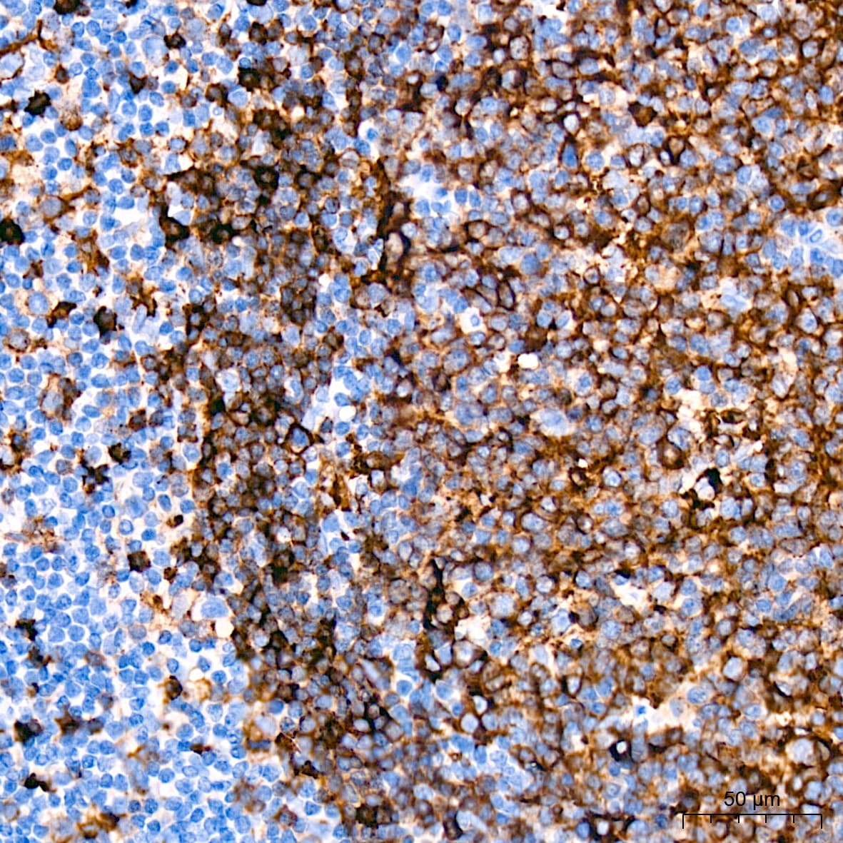 HLA-DR Antibody (4Y9Y8)