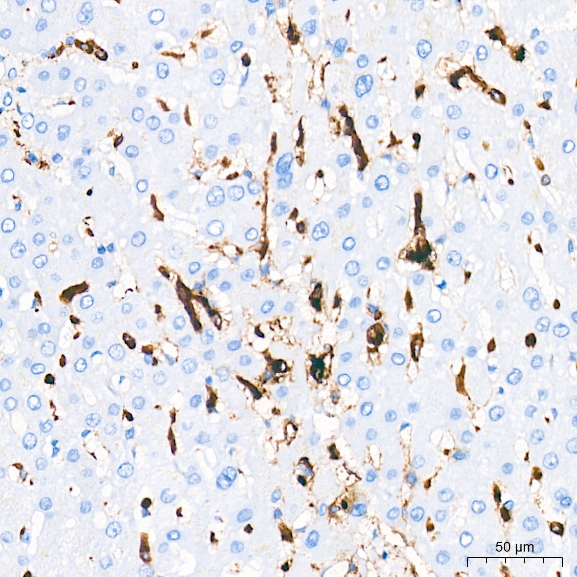 HLA-DR Antibody (4Y9Y8)