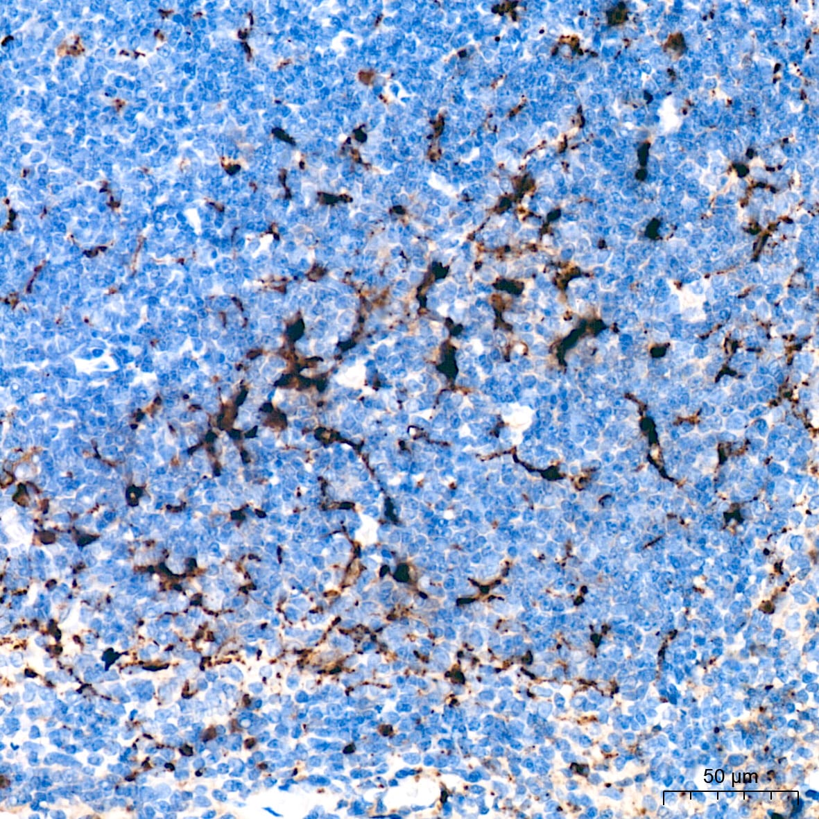 Lysozyme Antibody (2Y5E4)