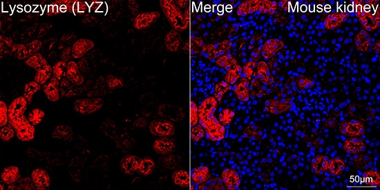 Lysozyme Antibody (2Y5E4)