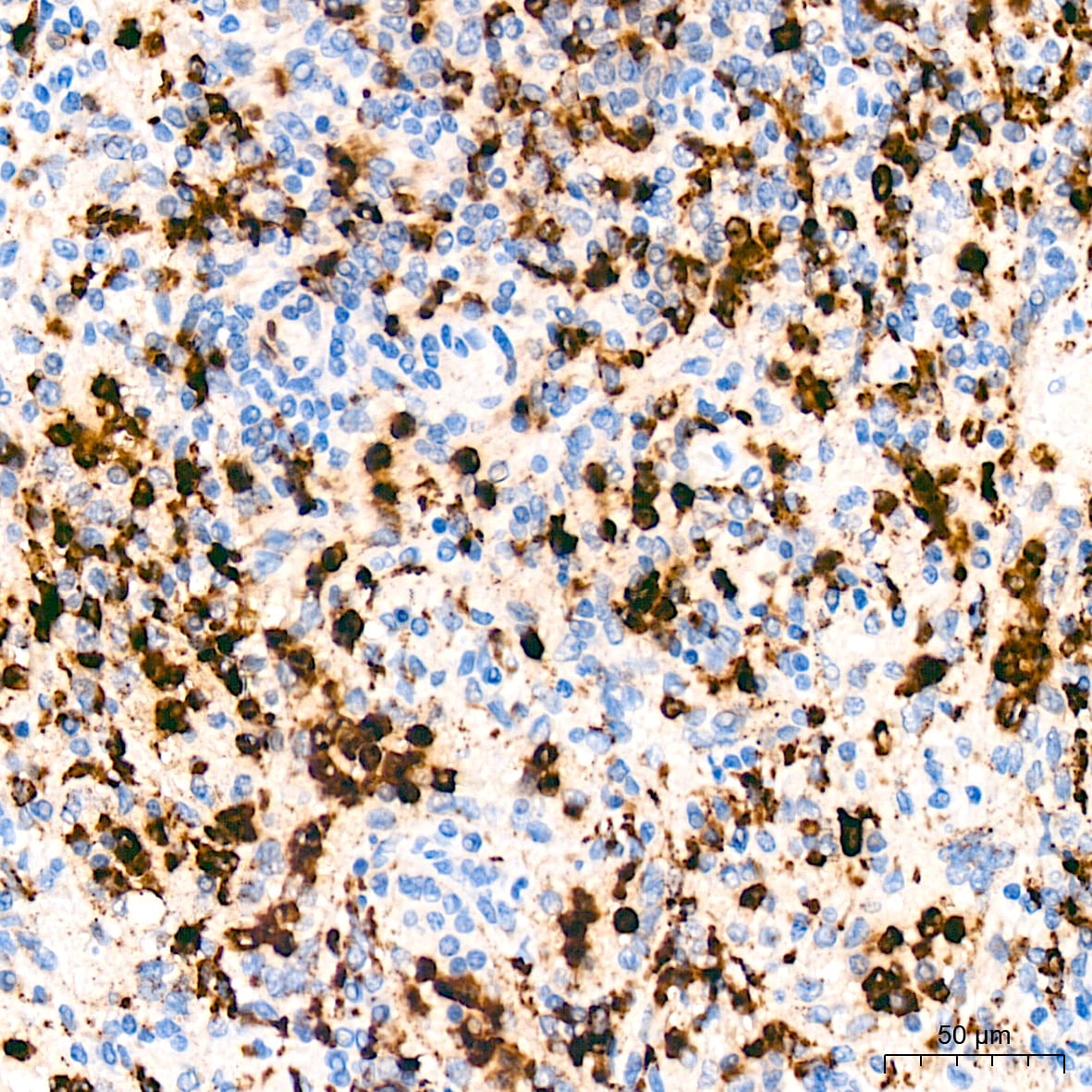Lysozyme Antibody (2Y5E4)