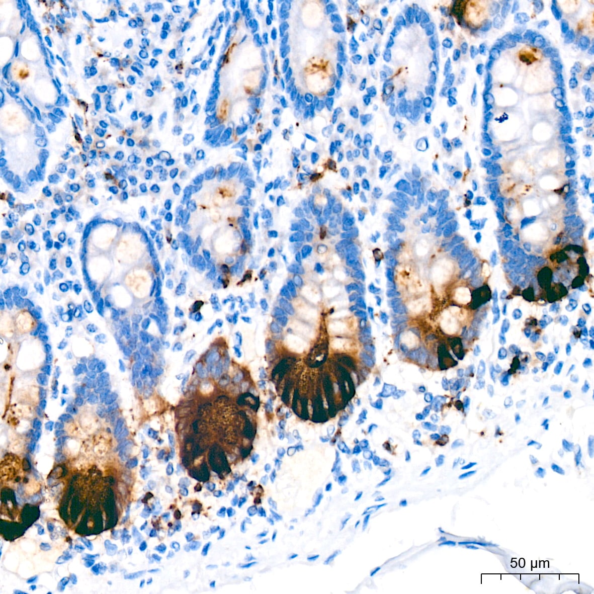 Lysozyme Antibody (2Y5E4)