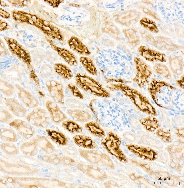 Lysozyme Antibody (ARQ4974)