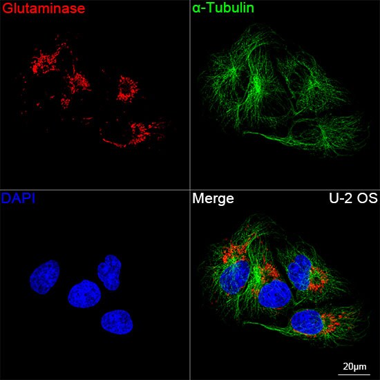 Glutaminase Antibody (8R8J6)