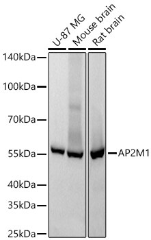 AP2M1 Antibody (10J8D1)