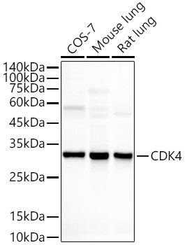 CDK4 Antibody (6N3M6)