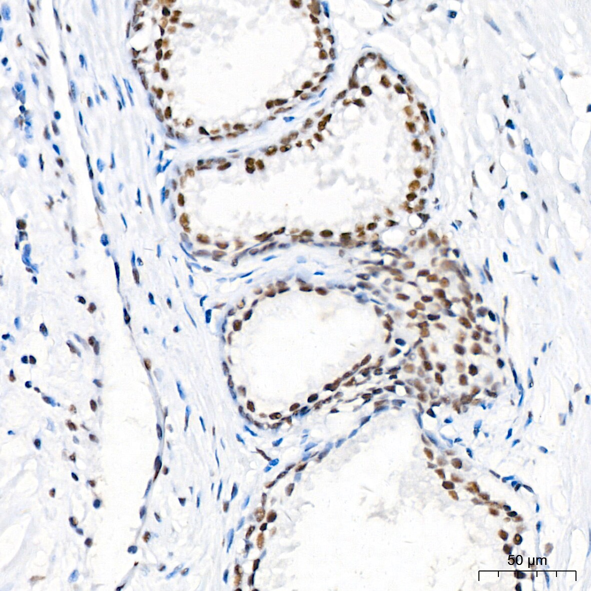 CDK4 Antibody (6N3M6)