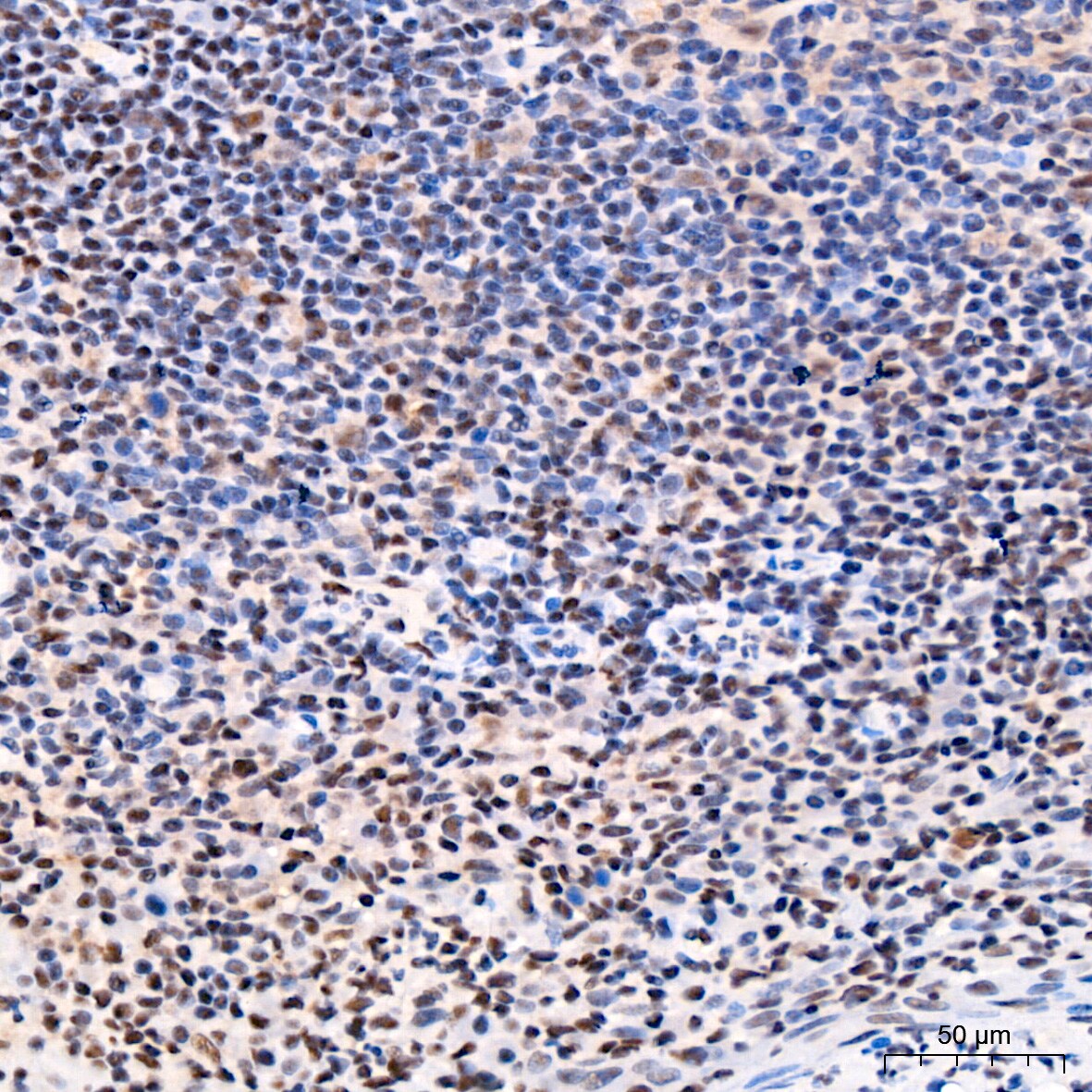 CDK4 Antibody (6N3M6)