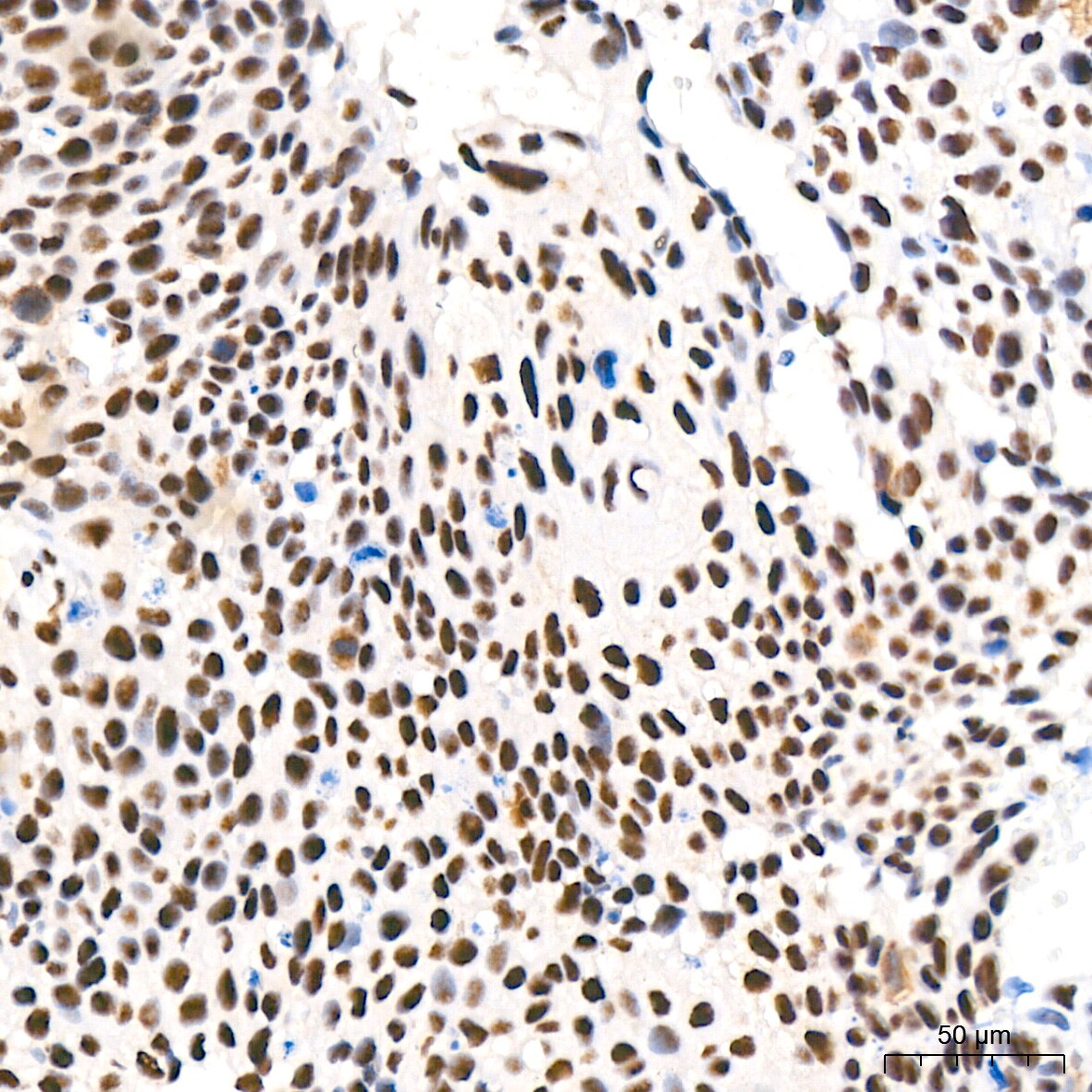 CDK4 Antibody (6N3M6)