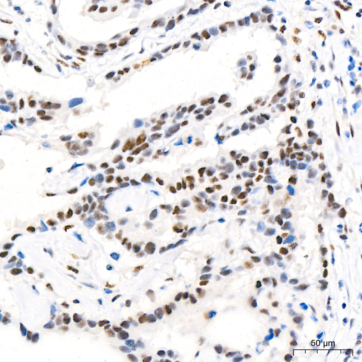 CDK4 Antibody (6N3M6)