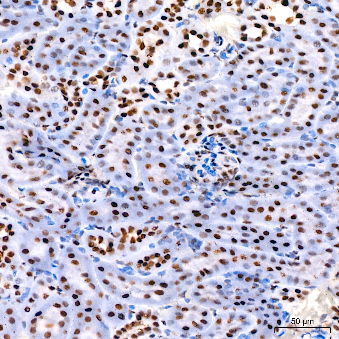 Cdk9 Antibody (1C4E3)