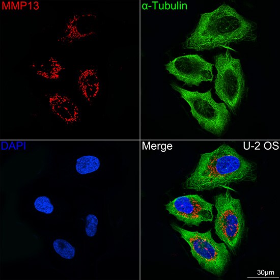 MMP-13 Antibody (8L8Q1)