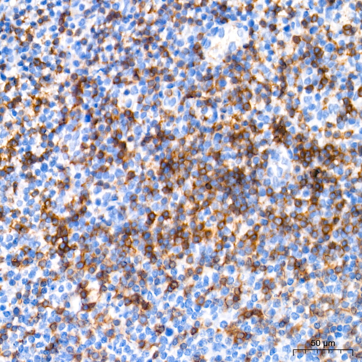 CD3 zeta Antibody (1T5R7)
