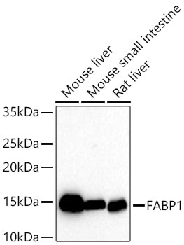 FABP1/L-FABP Antibody (8Q8S10)
