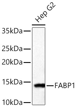 FABP1/L-FABP Antibody (8Q8S10)