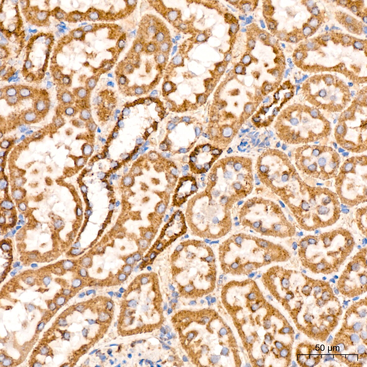 ATPB Antibody (1H2W2)