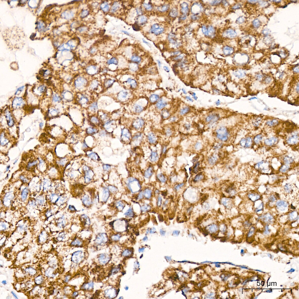 ATPB Antibody (1H2W2) NBP3-15354: Novus Biologicals