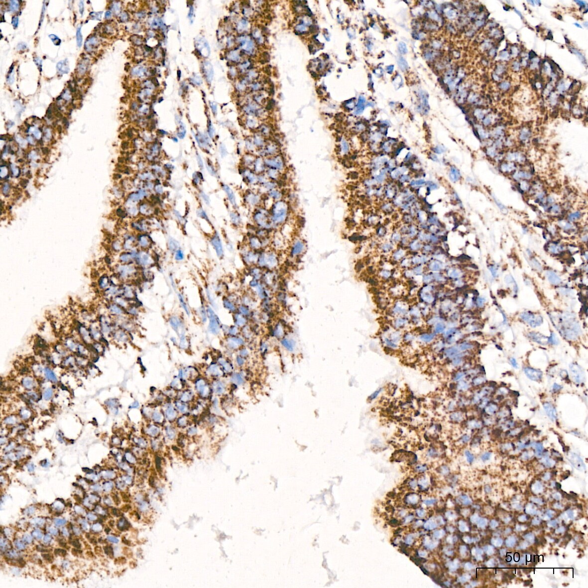 ATPB Antibody (1H2W2)