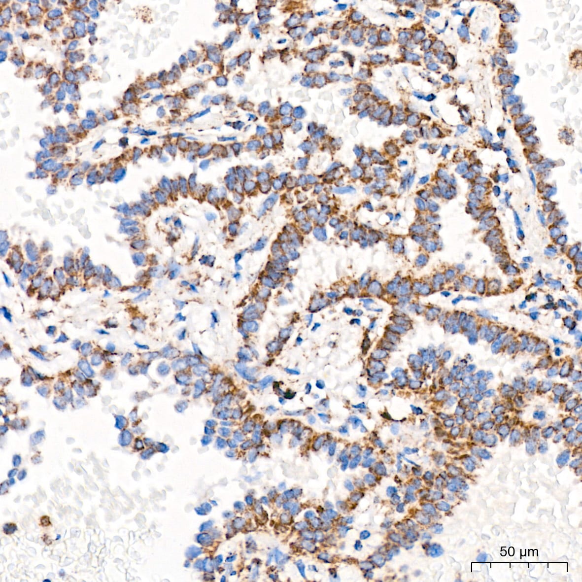 ATPB Antibody (1H2W2)