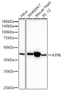 ATPB Antibody (9A1O2)