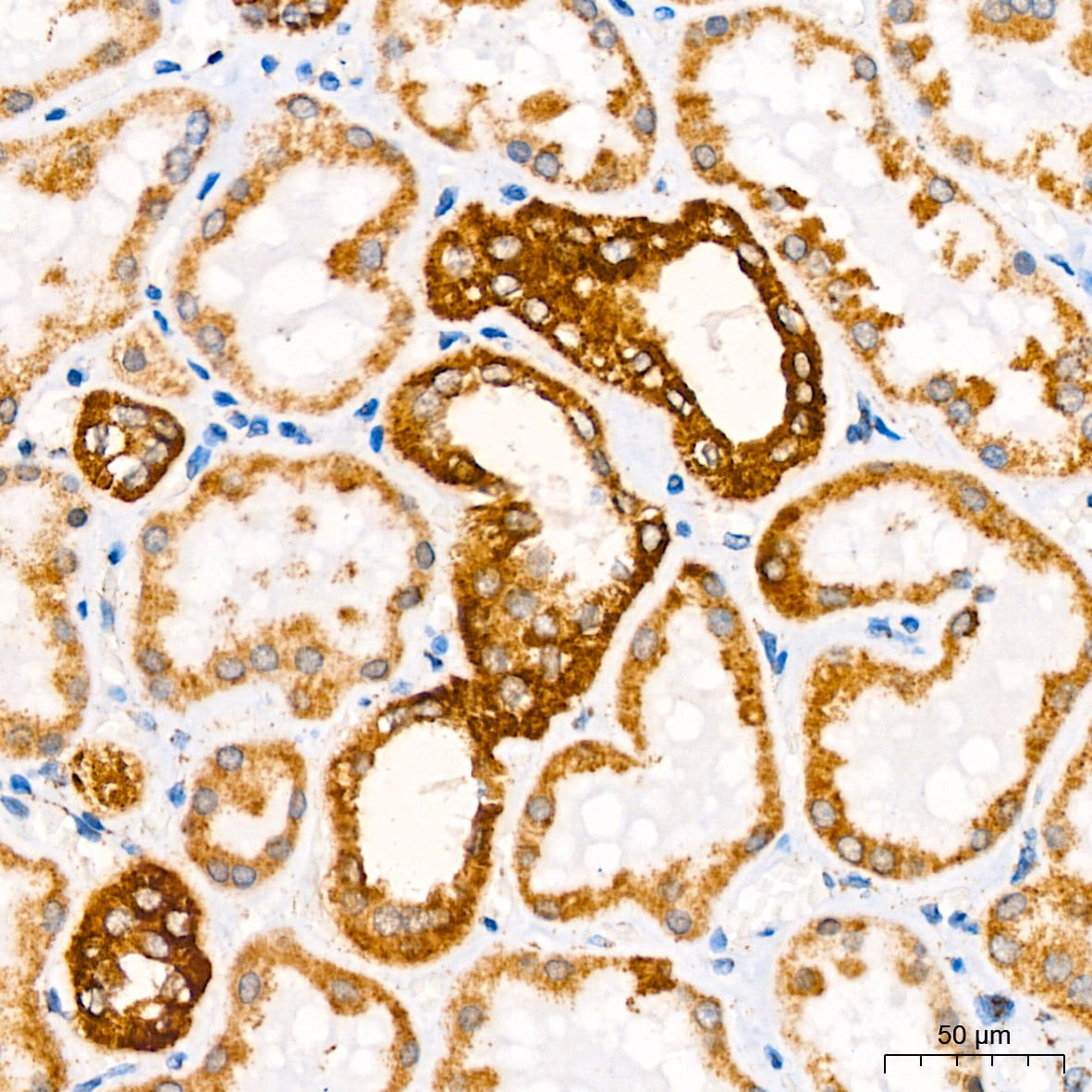 ATP5A Antibody (6M3B8)