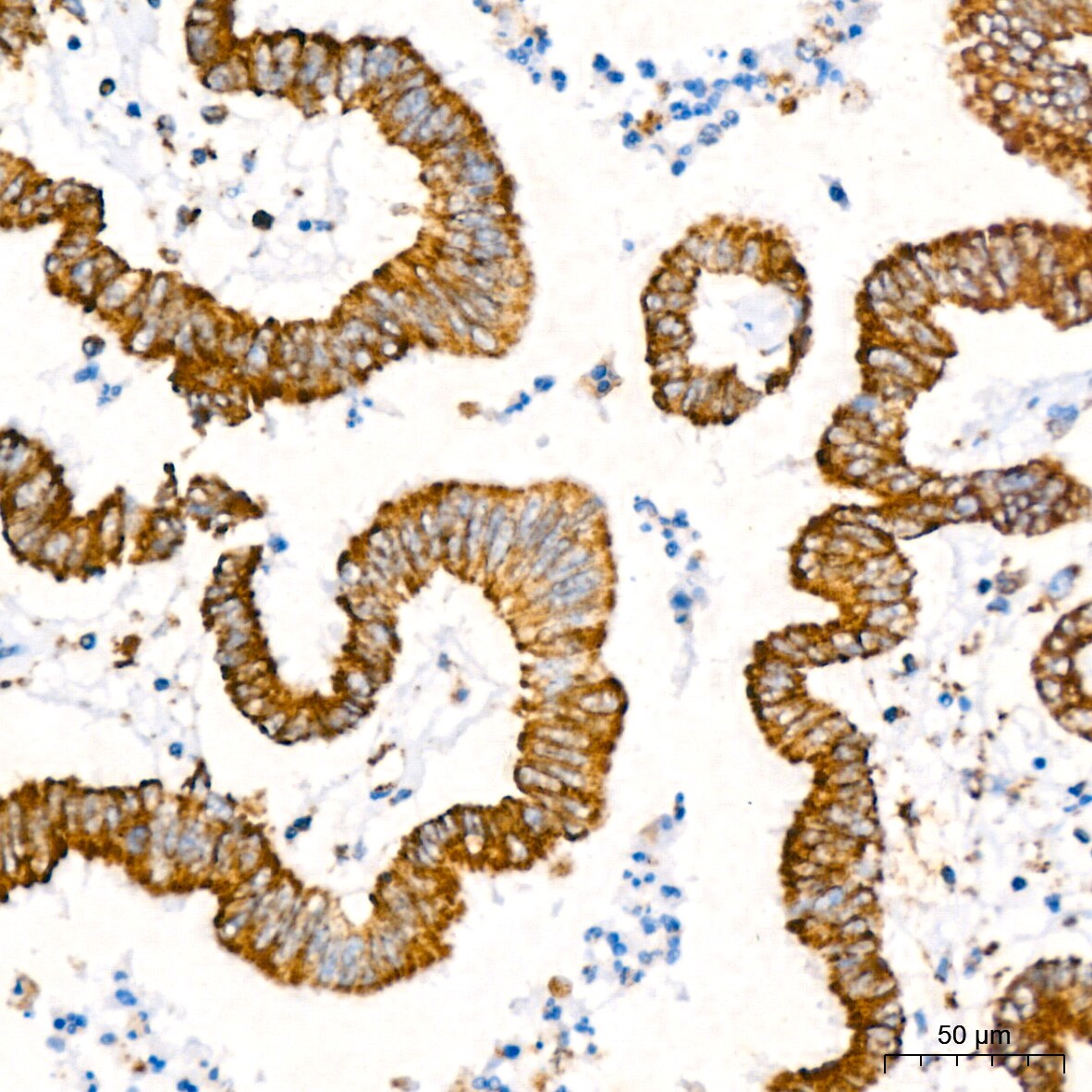 ATP5A Antibody (6M3B8)