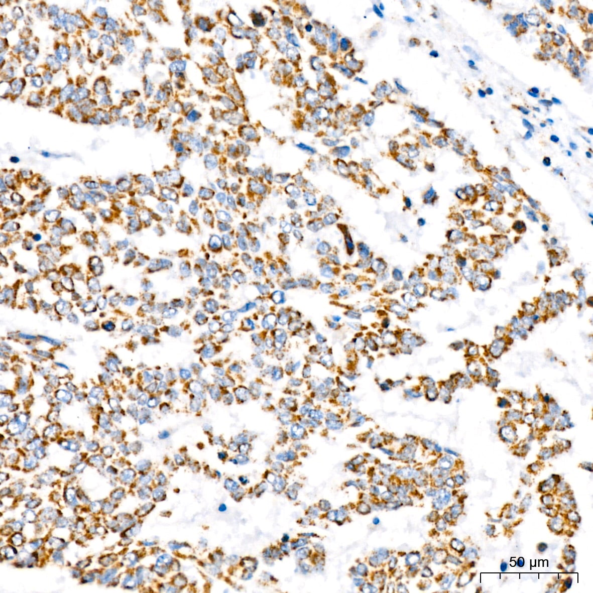 ATP5A Antibody (6M3B8)