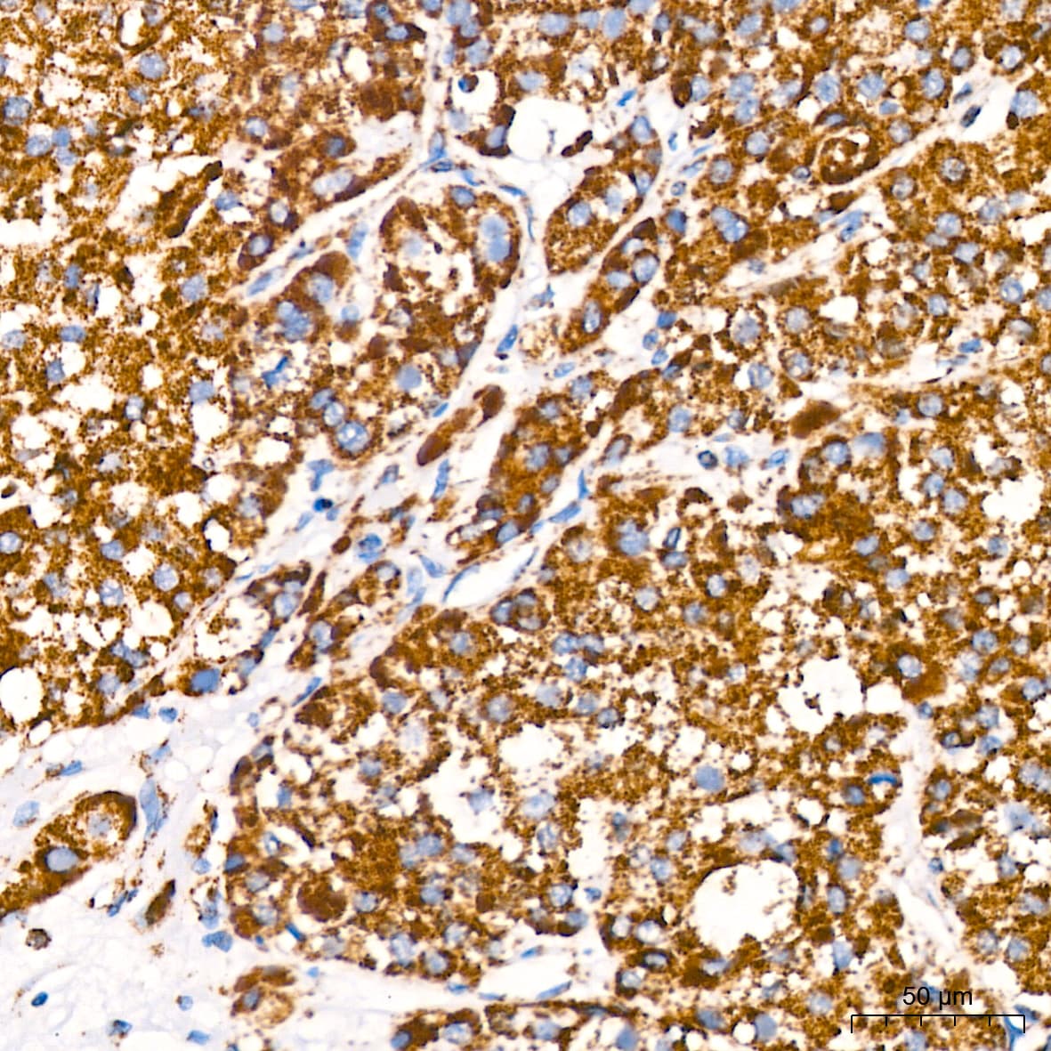 ATP5A Antibody (6M3B8)