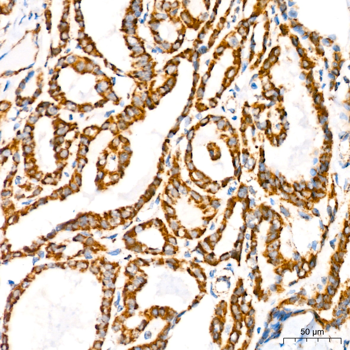 ATP5A Antibody (6M3B8)