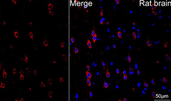 ATP5A Antibody (6M3B8)