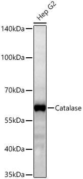 Catalase Antibody (7D2Y4)
