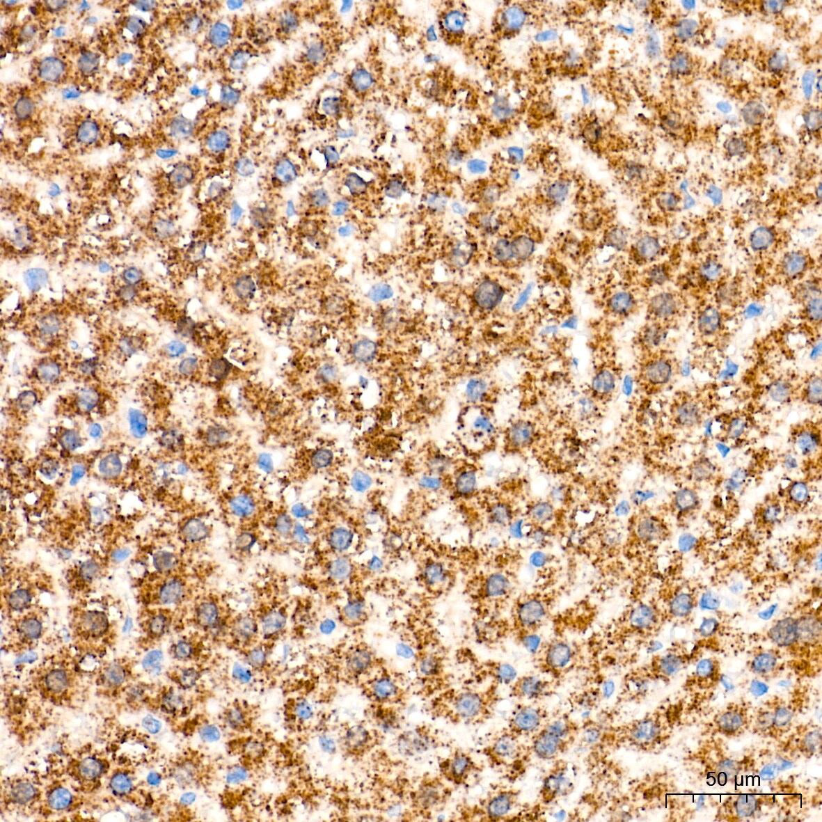 Catalase Antibody (7D2Y4)