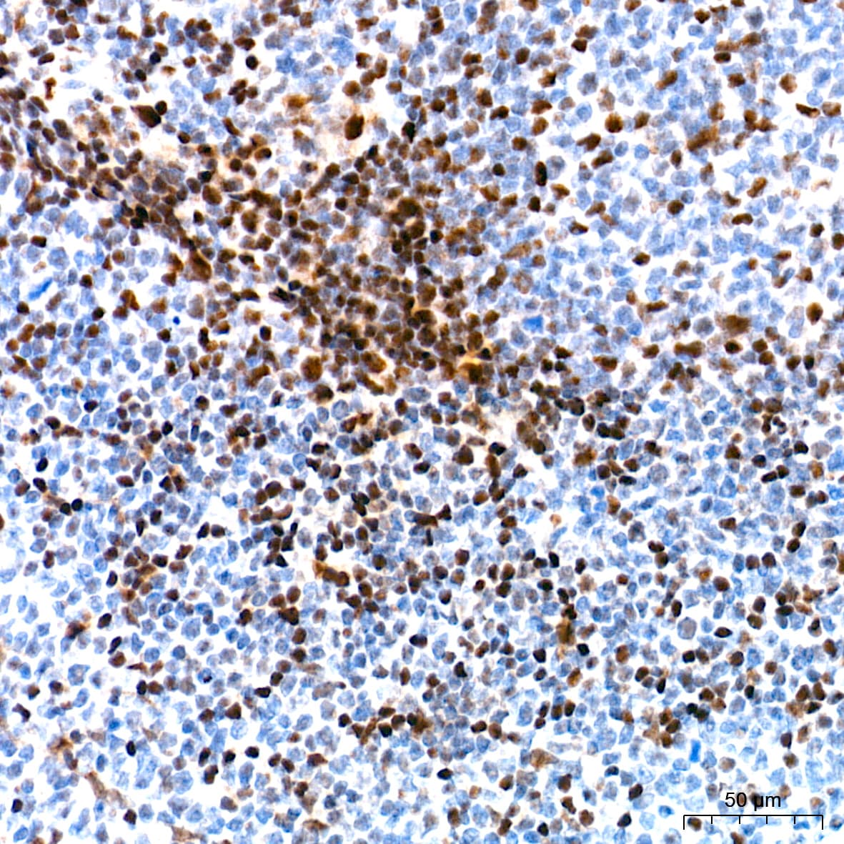 Ku70/XRCC6 Antibody (8L6B6)