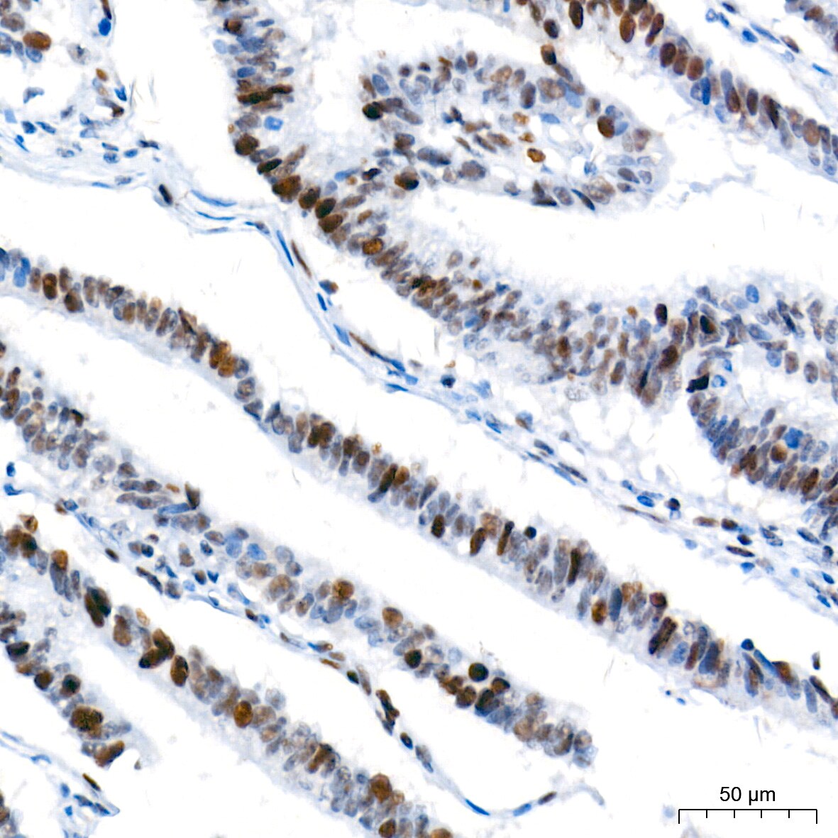 Ku70/XRCC6 Antibody (8L6B6)