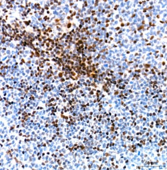 Ku70/XRCC6 Antibody (8L6B6)