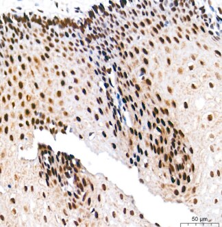 Ku70/XRCC6 Antibody (8L6B6)