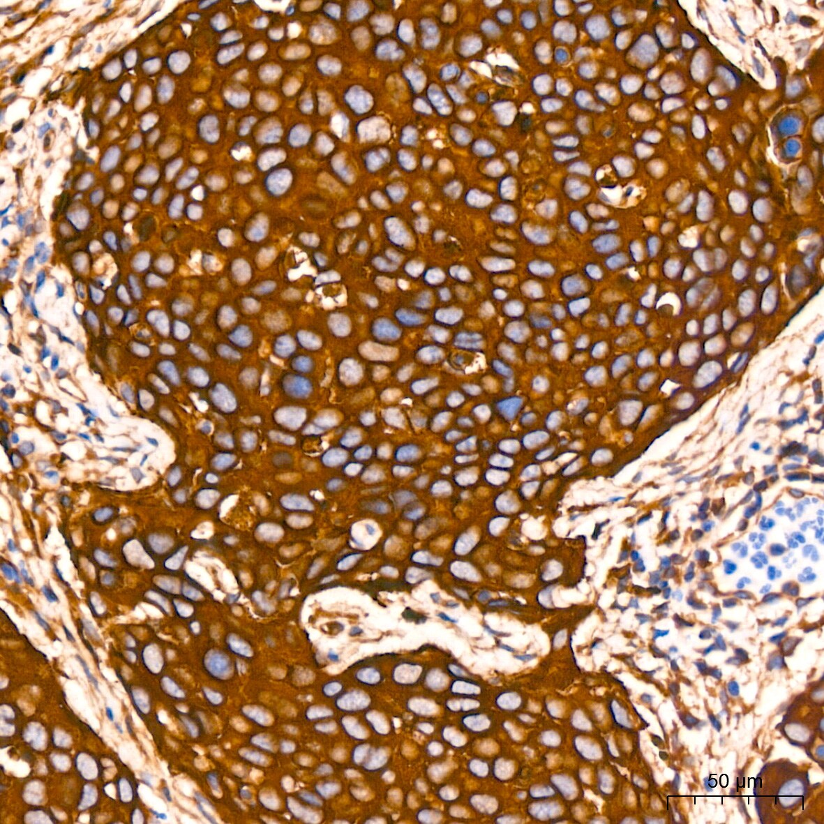 Annexin A2 Antibody (1W2B5)