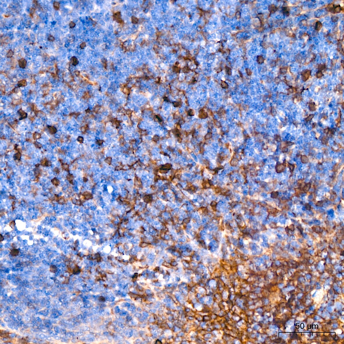 Annexin A2 Antibody (1W2B5)